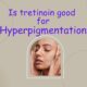 is tretinoin good for hyperpigmentation